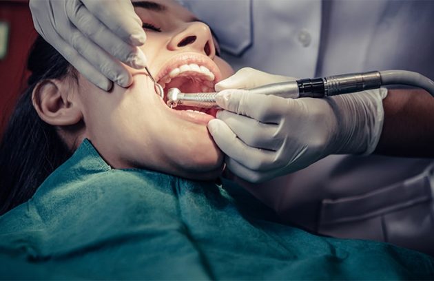 Dental Fillings New Westminster