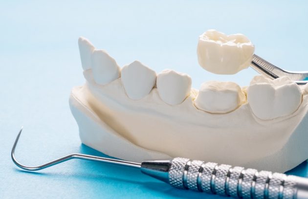 Dental Crown Problems
